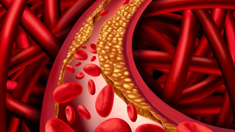 Conditions Treated Peripheral Artery Disease