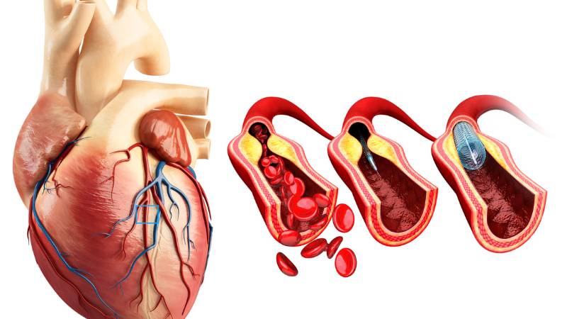 Conditions Treated Stenosis