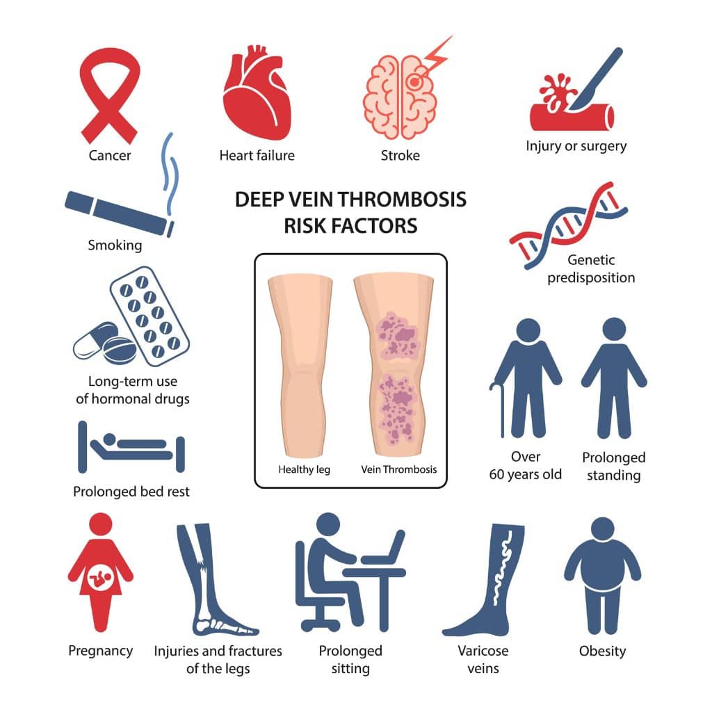 Deep Vein Thrombosis