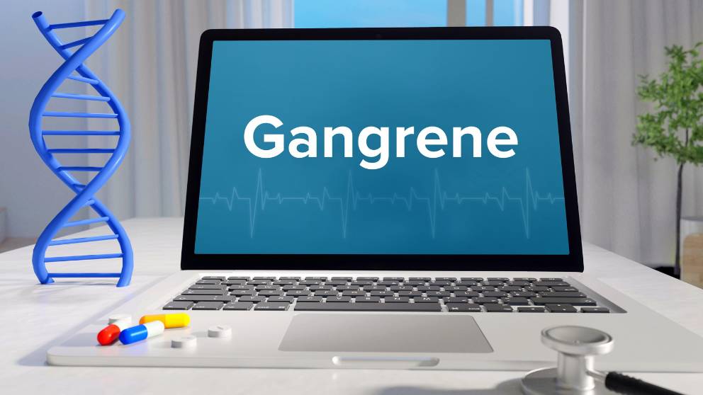 Gangrene