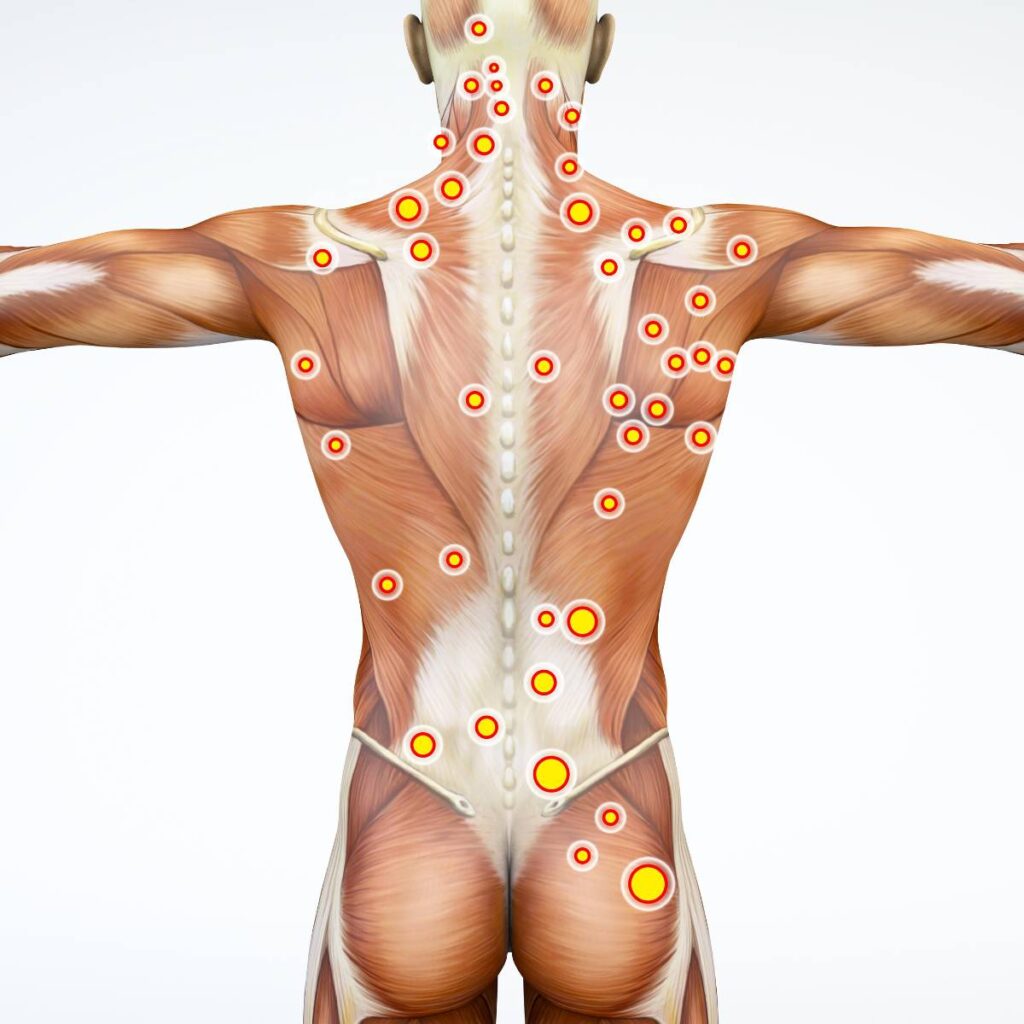 Imaging & Interventional Specialists - Your Muscle Pain Solution