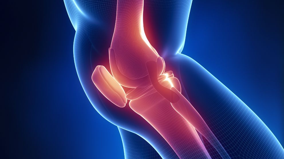Knee Pain/Osteoarthritis Solution