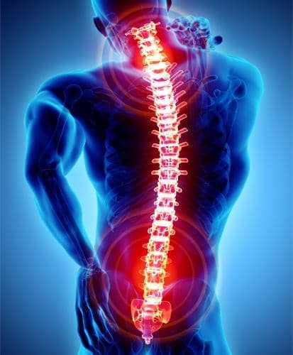 What are some common causes of back pain?
