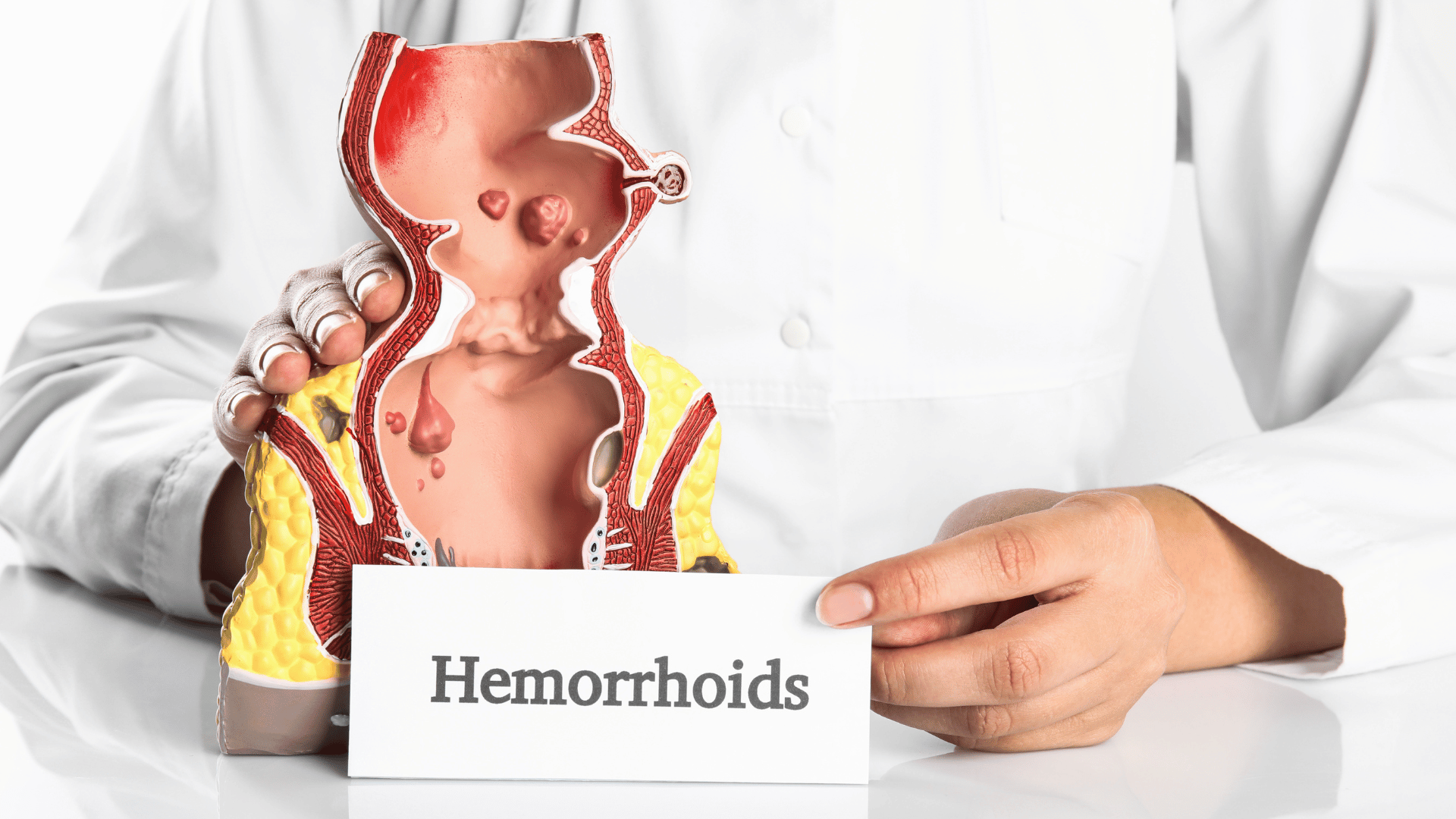 Hemorrhoids